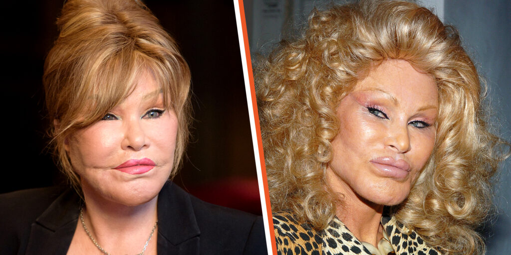 How ‘Catwoman’ Jocelyn Wildenstein Would Look If She Never Changed Her ...